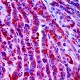 BRAF V600 Mutation Detection